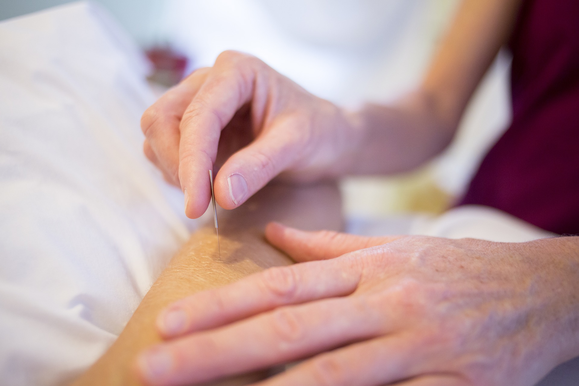 ACUPUNTURA DISTAL PAGINA